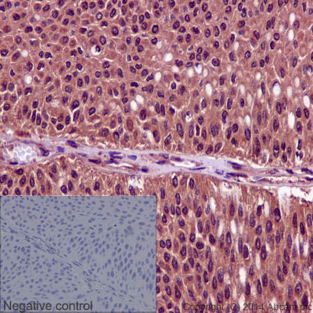 Immunohistochemistry (Formalin/PFA-fixed paraffin-embedded sections) - Anti-CDK1 + CDK2 + CDK3 + CDK5 (phospho Y15) antibody [EPR2233Y] (ab76146), expandable thumbnail