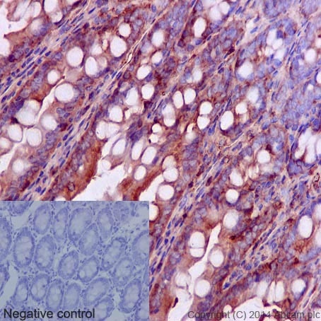 Immunohistochemistry (Formalin/PFA-fixed paraffin-embedded sections) - Anti-CDK1 + CDK2 + CDK3 + CDK5 (phospho Y15) antibody [EPR2233Y] (AB76146), expandable thumbnail