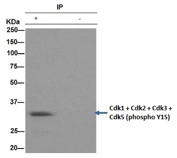 Immunoprecipitation - Anti-CDK1 + CDK2 + CDK3 + CDK5 (phospho Y15) antibody [EPR2233Y] (AB76146), expandable thumbnail