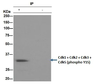 Immunoprecipitation - Anti-CDK1 + CDK2 + CDK3 + CDK5 (phospho Y15) antibody [EPR2233Y] (AB76146)