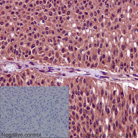 Immunohistochemistry (Formalin/PFA-fixed paraffin-embedded sections) - Anti-CDK1 + CDK2 + CDK3 + CDK5 (phospho Y15) antibody [EPR2233Y] - BSA and Azide free (AB176312)