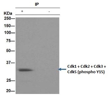 Immunoprecipitation - Anti-CDK1 + CDK2 + CDK3 + CDK5 (phospho Y15) antibody [EPR2233Y] - BSA and Azide free (AB176312), expandable thumbnail