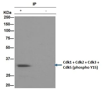 Immunoprecipitation - Anti-CDK1 + CDK2 + CDK3 + CDK5 (phospho Y15) antibody [EPR2233Y] - BSA and Azide free (AB176312)