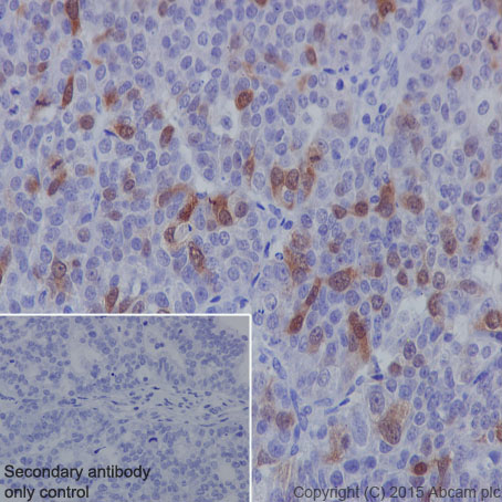 Immunohistochemistry (Formalin/PFA-fixed paraffin-embedded sections) - Anti-CDK1 + Cdk2 + Cdk3 (phospho T14) antibody [E161] (AB32384)