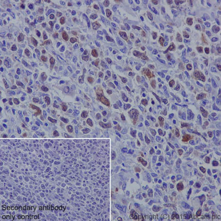 Immunohistochemistry (Formalin/PFA-fixed paraffin-embedded sections) - Anti-CDK1 + Cdk2 + Cdk3 (phospho T14) antibody [E161] - BSA and Azide free (AB219586)