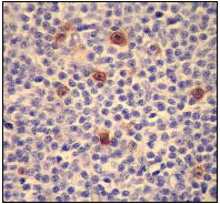 Immunohistochemistry (Formalin/PFA-fixed paraffin-embedded sections) - Anti-CDK1 + Cdk2 + Cdk3 (phospho T14) antibody [E161] - BSA and Azide free (AB219586)