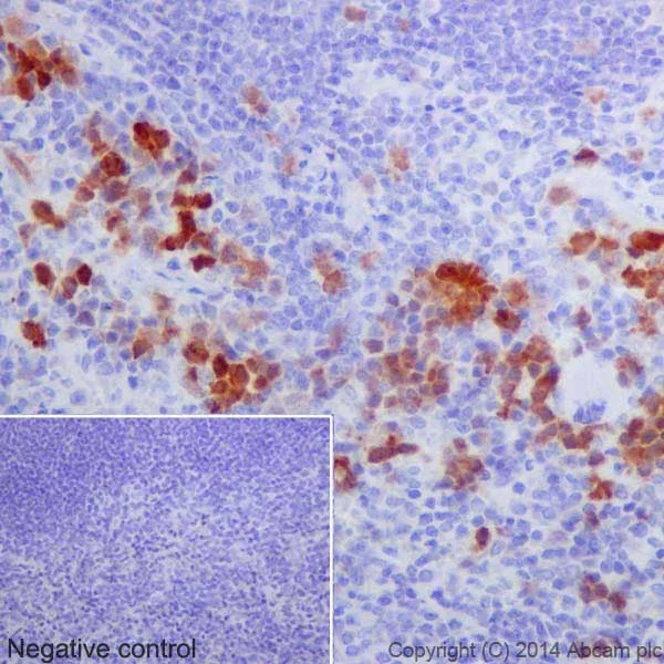Immunohistochemistry (Formalin/PFA-fixed paraffin-embedded sections) - Anti-Cdk1 + Cdk2 (phospho T14) antibody [EPR17499] - BSA and Azide free (AB250674)