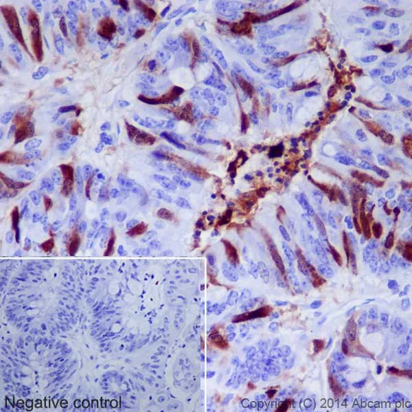 Immunohistochemistry (Formalin/PFA-fixed paraffin-embedded sections) - Anti-Cdk1 + Cdk2 (phospho T14) antibody [EPR17499] - BSA and Azide free (AB250674)