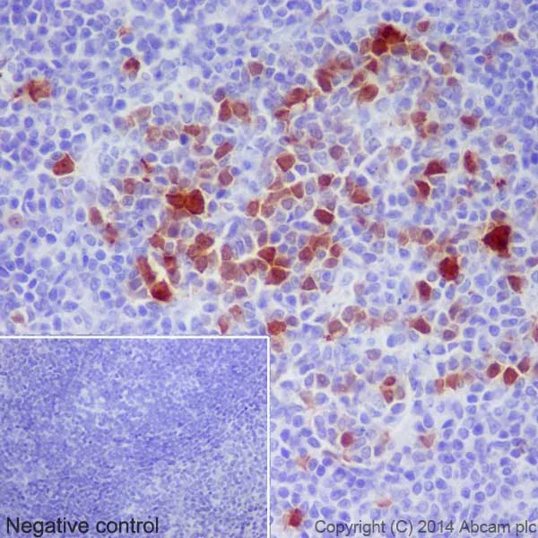 Immunohistochemistry (Formalin/PFA-fixed paraffin-embedded sections) - Anti-Cdk1 + Cdk2 (phospho T14) antibody [EPR17499] - BSA and Azide free (AB250674)