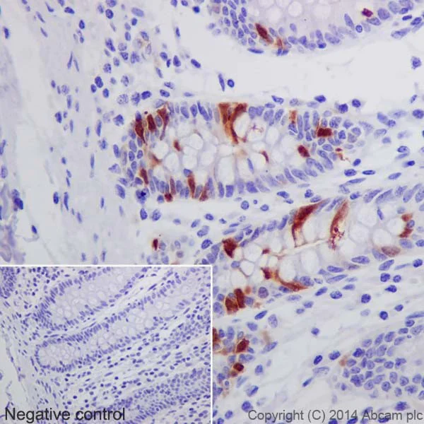 Immunohistochemistry (Formalin/PFA-fixed paraffin-embedded sections) - Anti-Cdk1 + Cdk2 (phospho T14) antibody [EPR17499] - BSA and Azide free (AB250674)