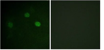 Immunocytochemistry/ Immunofluorescence - Anti-CDK1 (phospho T14) + CDK2 (phospho T14) + CDK3 (phospho T14) antibody (AB58509)