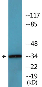 Western blot - Anti-CDK1 (phospho T161) antibody (AB138389)