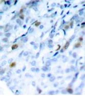 Immunohistochemistry (Formalin/PFA-fixed paraffin-embedded sections) - Anti-CDK1 (phospho T161) antibody (AB194874)