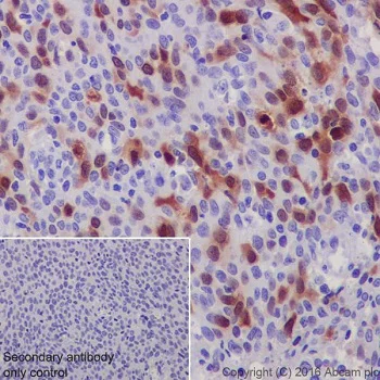 Immunohistochemistry (Formalin/PFA-fixed paraffin-embedded sections) - Anti-CDK1 (phospho T161) + CDK2 / CDK3 (phospho T160) antibody [EPR19546] (AB201008)