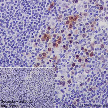 Immunohistochemistry (Formalin/PFA-fixed paraffin-embedded sections) - Anti-CDK1 (phospho T161) + CDK2 / CDK3 (phospho T160) antibody [EPR19546] (AB201008)