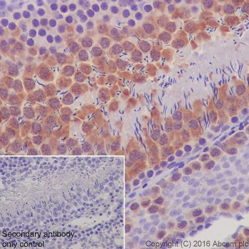 Immunohistochemistry (Formalin/PFA-fixed paraffin-embedded sections) - Anti-CDK1 (phospho T161) + CDK2 / CDK3 (phospho T160) antibody [EPR19546] (AB201008)