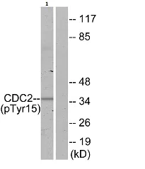 Western blot - Anti-CDK1 (phospho Y15) antibody (AB47594)
