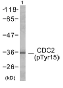 Western blot - Anti-CDK1 (phospho Y15) antibody (AB47594)