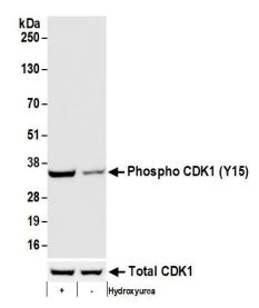 Western blot - Anti-CDK1 (phospho Y15) antibody [BLR101H] (AB275958)