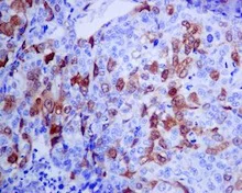 Immunohistochemistry (Formalin/PFA-fixed paraffin-embedded sections) - Anti-CDK1 (phospho Y15) + CDK2 (phospho Y15) + CDK3 (phospho Y15) + CDK5 (phospho Y15) antibody [EPR (AB133463)