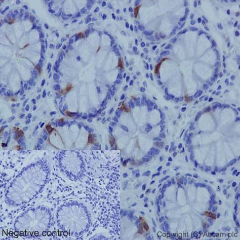 Immunohistochemistry (Formalin/PFA-fixed paraffin-embedded sections) - Anti-CDK1 (phospho Y15) + CDK2 (phospho Y15) + CDK3 (phospho Y15) + CDK5 (phospho Y15) antibody [EPR7875] - BSA and Azide free (AB248508), expandable thumbnail