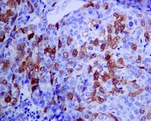 Immunohistochemistry (Formalin/PFA-fixed paraffin-embedded sections) - Anti-CDK1 (phospho Y15) + CDK2 (phospho Y15) + CDK3 (phospho Y15) + CDK5 (phospho Y15) antibody [EPR7875] - BSA and Azide free (ab248508), expandable thumbnail