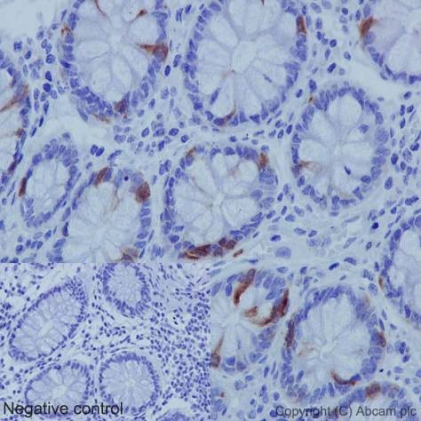 Immunohistochemistry (Formalin/PFA-fixed paraffin-embedded sections) - Anti-CDK1 (phospho Y15) + CDK2 (phospho Y15) + CDK3 (phospho Y15) + CDK5 (phospho Y15) antibody [EPR7875] - BSA and Azide free (ab248508), expandable thumbnail