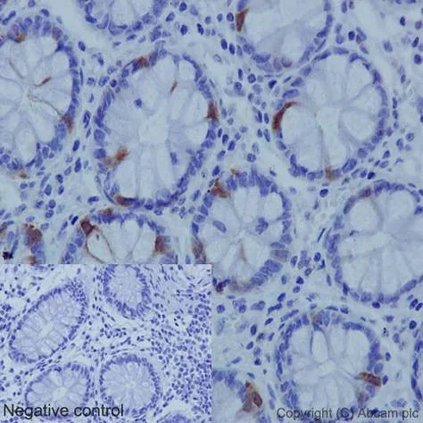 Immunohistochemistry (Formalin/PFA-fixed paraffin-embedded sections) - Anti-CDK1 (phospho Y15) + CDK2 (phospho Y15) + CDK3 (phospho Y15) + CDK5 (phospho Y15) antibody [EPR7875] - BSA and Azide free (AB248508)