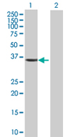 Western blot - Anti-CDK10 antibody (AB67828)