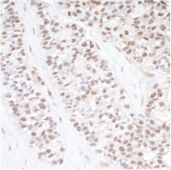 Immunohistochemistry (Formalin/PFA-fixed paraffin-embedded sections) - Anti-CDK11/CDC2L2/CDK11A antibody (AB19393), expandable thumbnail