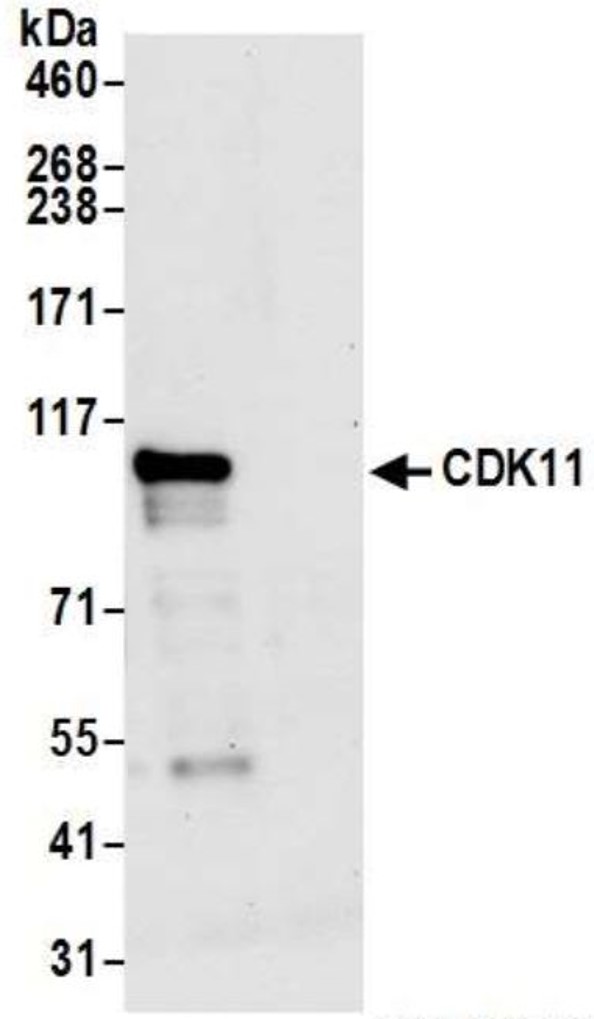 Immunoprecipitation - Anti-CDK11/CDC2L2/CDK11A antibody (AB19393), expandable thumbnail