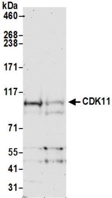 Western blot - Anti-CDK11/CDC2L2/CDK11A antibody (AB19393), expandable thumbnail