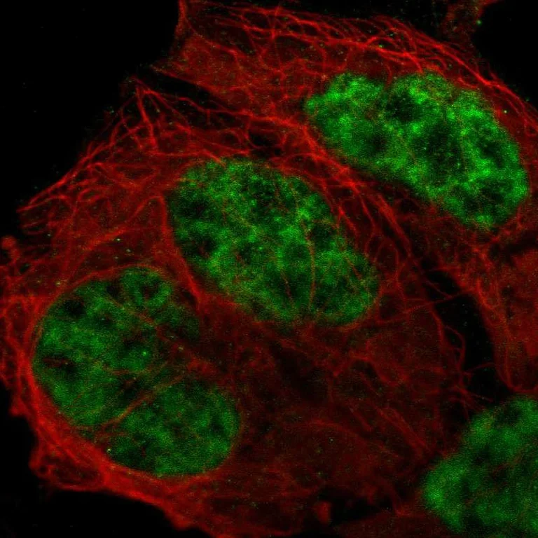 Immunocytochemistry/ Immunofluorescence - Anti-CDK12 antibody (AB246887)