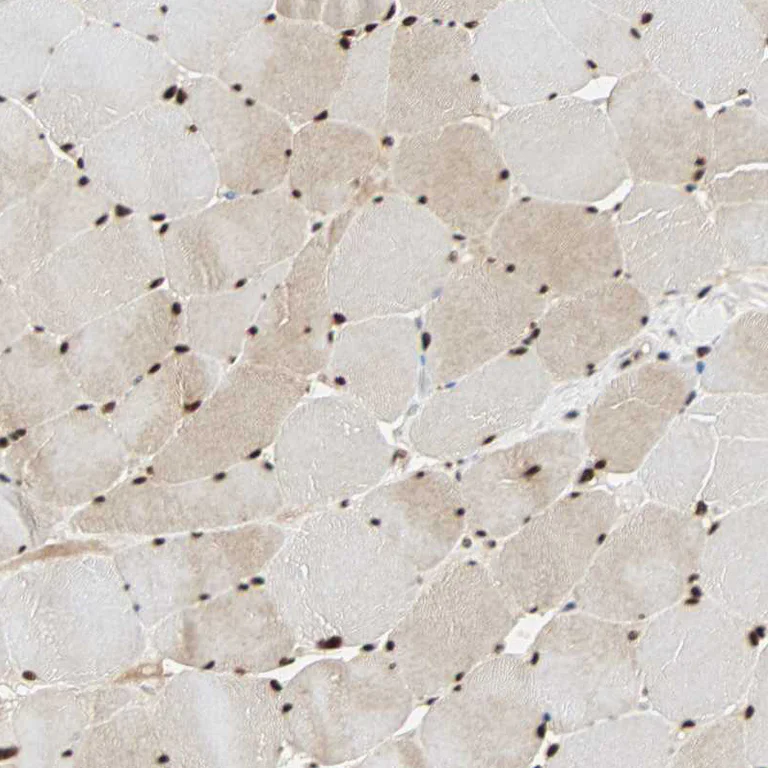 Immunohistochemistry (Formalin/PFA-fixed paraffin-embedded sections) - Anti-CDK12 antibody (AB246887)