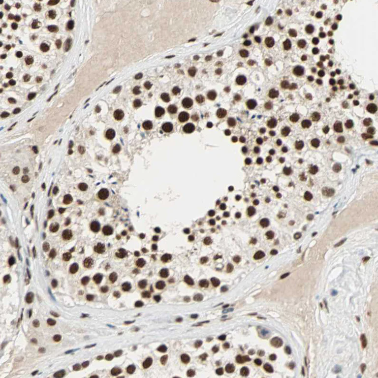Immunohistochemistry (Formalin/PFA-fixed paraffin-embedded sections) - Anti-CDK12 antibody (AB246887)