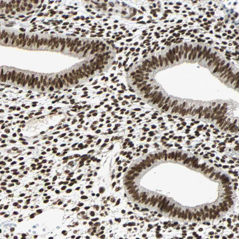 Immunohistochemistry (Formalin/PFA-fixed paraffin-embedded sections) - Anti-CDK12 antibody (AB246887)
