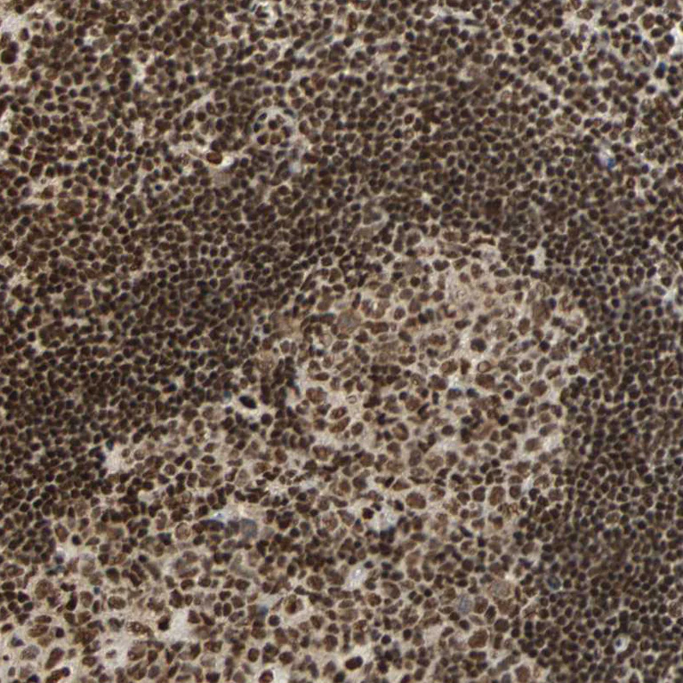 Immunohistochemistry (Formalin/PFA-fixed paraffin-embedded sections) - Anti-CDK12 antibody (AB246887)