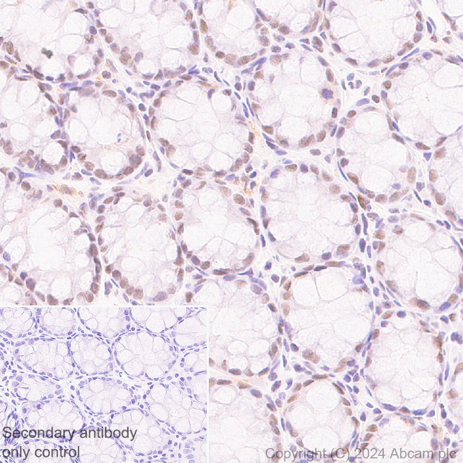 Immunohistochemistry (Formalin/PFA-fixed paraffin-embedded sections) - Anti-CDK12 antibody [EPR29009-30] (ab317746), expandable thumbnail