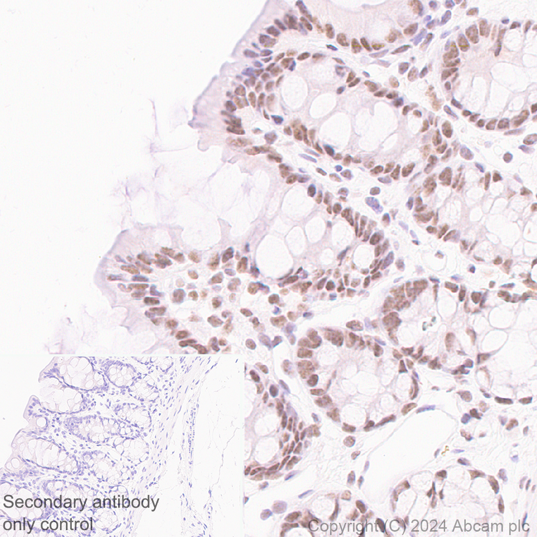 Immunohistochemistry (Formalin/PFA-fixed paraffin-embedded sections) - Anti-CDK12 antibody [EPR29009-30] (ab317746), expandable thumbnail