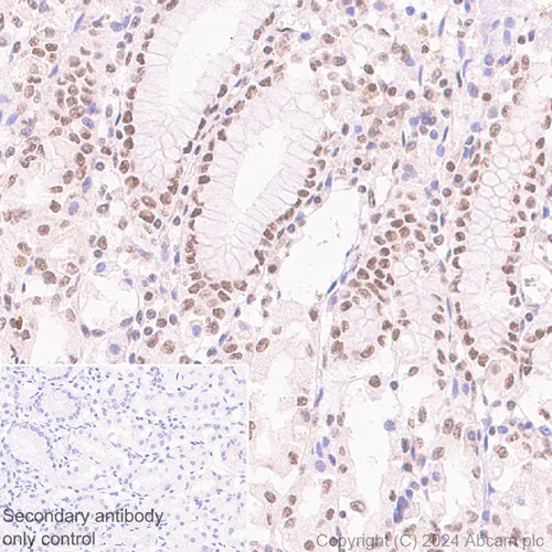 Immunohistochemistry (Formalin/PFA-fixed paraffin-embedded sections) - Anti-CDK12 antibody [EPR29009-30] - BSA and Azide free (AB317747)