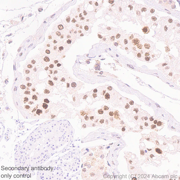 Immunohistochemistry (Formalin/PFA-fixed paraffin-embedded sections) - Anti-CDK12 antibody [EPR29009-30] - BSA and Azide free (AB317747)