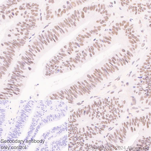 Immunohistochemistry (Formalin/PFA-fixed paraffin-embedded sections) - Anti-CDK12 antibody [EPR29009-30] - BSA and Azide free (AB317747)