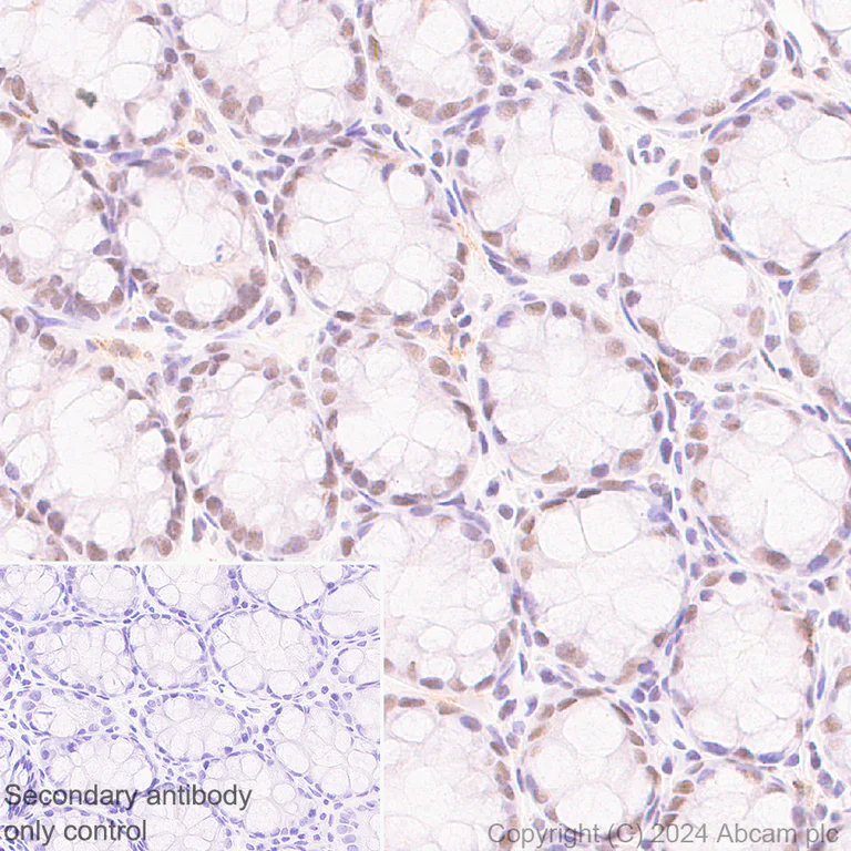 Immunohistochemistry (Formalin/PFA-fixed paraffin-embedded sections) - Anti-CDK12 antibody [EPR29009-30] - BSA and Azide free (AB317747)