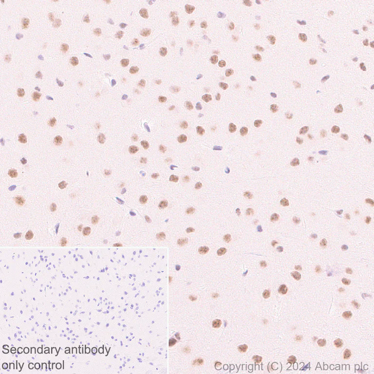 Immunohistochemistry (Formalin/PFA-fixed paraffin-embedded sections) - Anti-CDK12 antibody [EPR29009-30] - BSA and Azide free (AB317747)