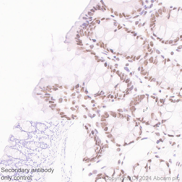 Immunohistochemistry (Formalin/PFA-fixed paraffin-embedded sections) - Anti-CDK12 antibody [EPR29009-30] - BSA and Azide free (AB317747)