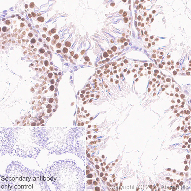 Immunohistochemistry (Formalin/PFA-fixed paraffin-embedded sections) - Anti-CDK12 antibody [EPR29009-30] - BSA and Azide free (AB317747)