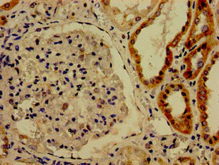 Immunohistochemistry (Formalin/PFA-fixed paraffin-embedded sections) - Anti-CDK13 antibody (AB238732)