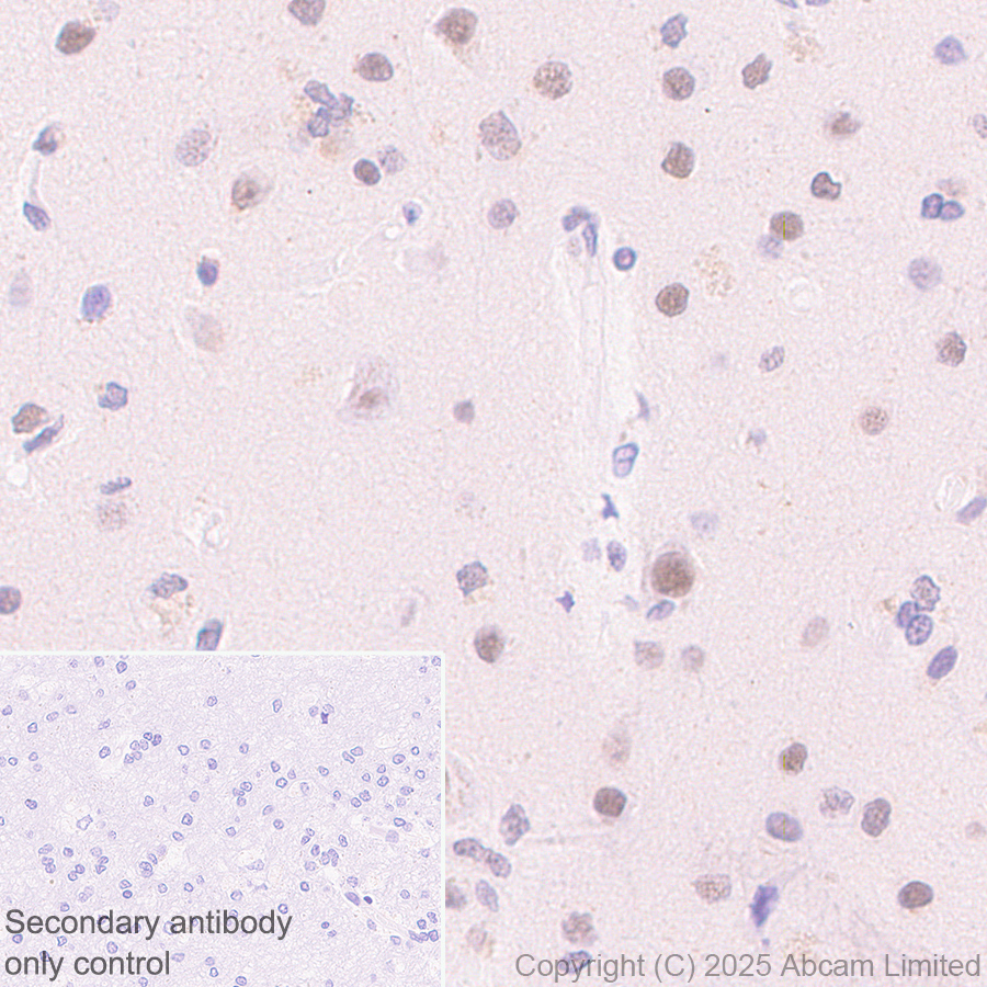 Immunohistochemistry (Formalin/PFA-fixed paraffin-embedded sections) - Anti-CDK13 antibody [EPR29353-534] (AB323865), expandable thumbnail