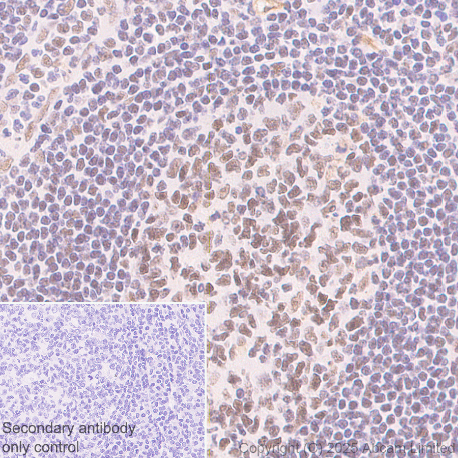 Immunohistochemistry (Formalin/PFA-fixed paraffin-embedded sections) - Anti-CDK13 antibody [EPR29353-534] (ab323865), expandable thumbnail