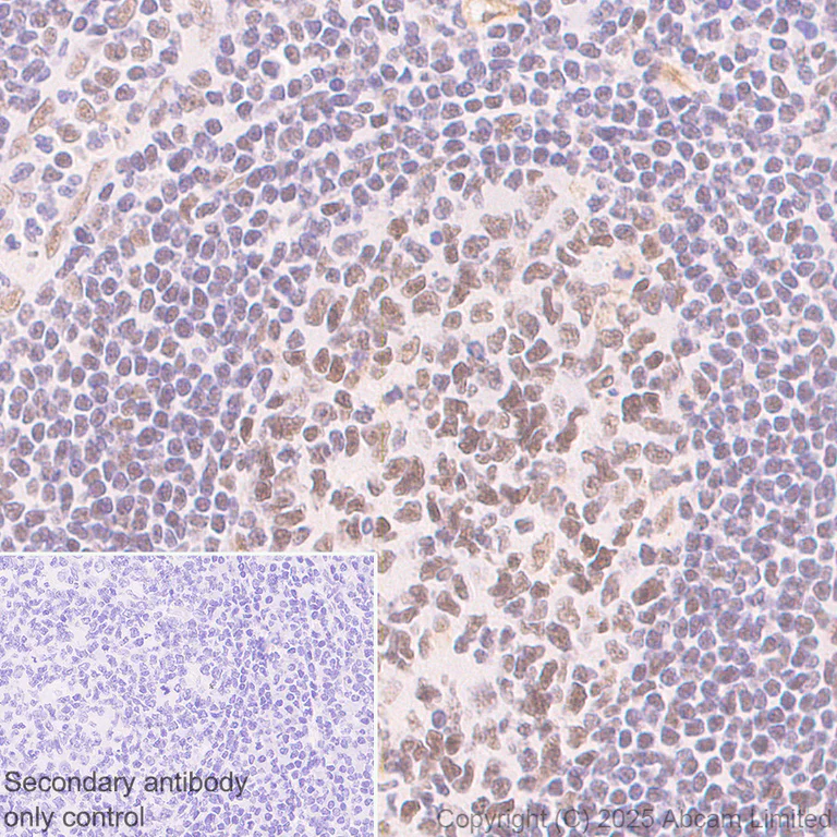 Immunohistochemistry (Formalin/PFA-fixed paraffin-embedded sections) - Anti-CDK13 antibody [EPR29353-534] (AB323865)